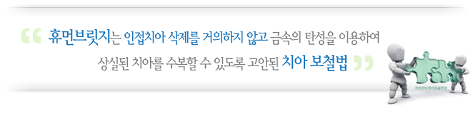 휴먼브릿지는 인접치아 삭제를 거의 하지않고 금속의 탄성을 이용하여 상실된 치아를 수복할 수 있도록 고안된 치아 보철법