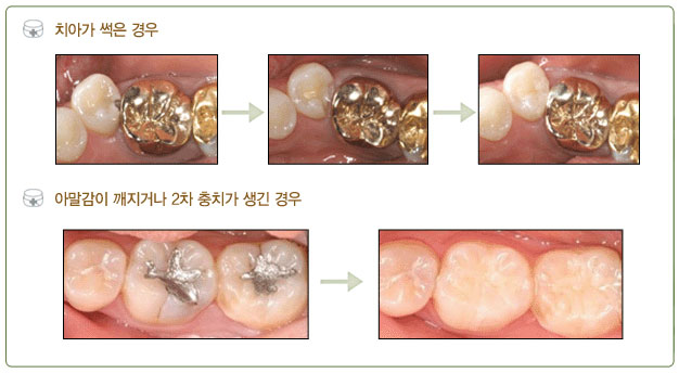 세렉인레이